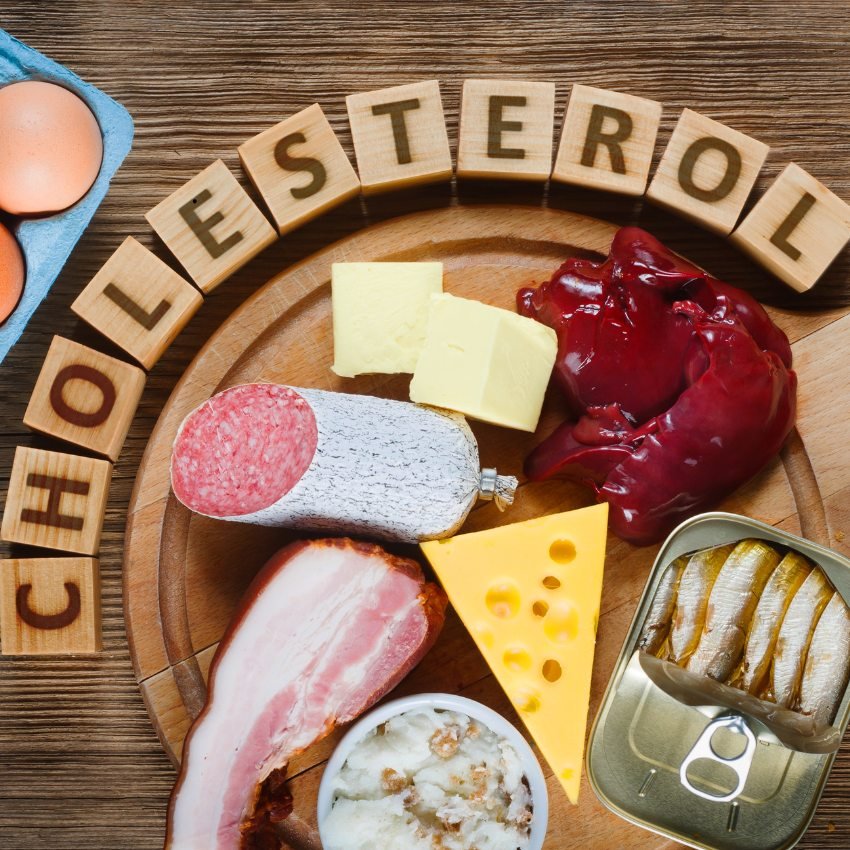 Un saucisson posée sur une planche sur laquelle est gravé le mot "cholesterol"
