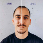 Un avant après d'un homme ayant utilisé la crème visage bonne mine blondépil