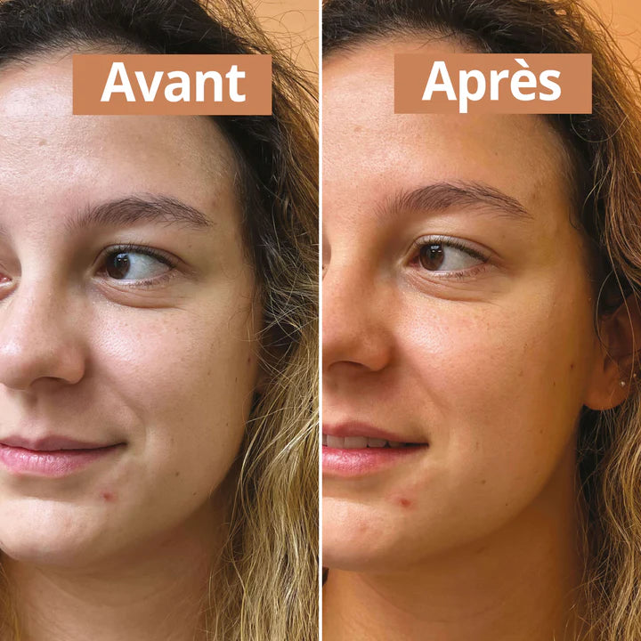 Un avant/après l'utilisation du Sérum visage bonne mine Comme Avant