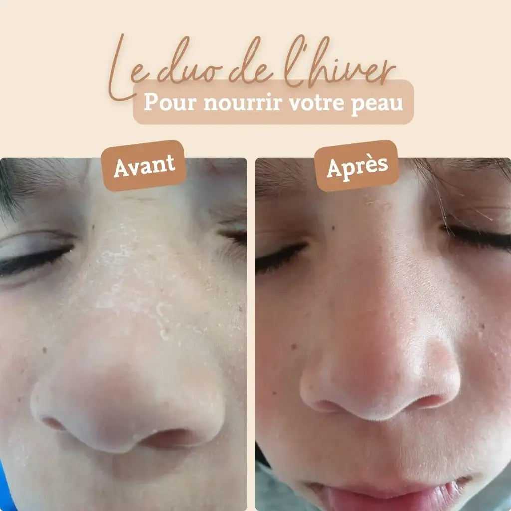 Photo avant et après utilisation de la  crème solide au beurre de karité de 50 g de la marque Comme Avant
