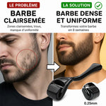 Dermaroller barbe 0,25mm avant-après : barbe clairsemée transformée en barbe dense et uniforme en 8 semaines