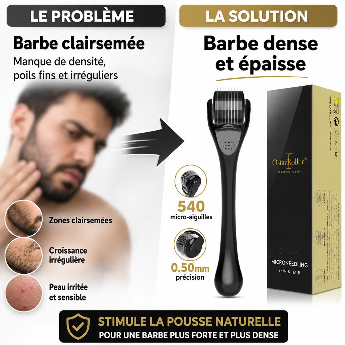 Dermaroller barbe 0,50mm noir - solution avant/après pour barbe dense et épaisse avec 540 microneedles
