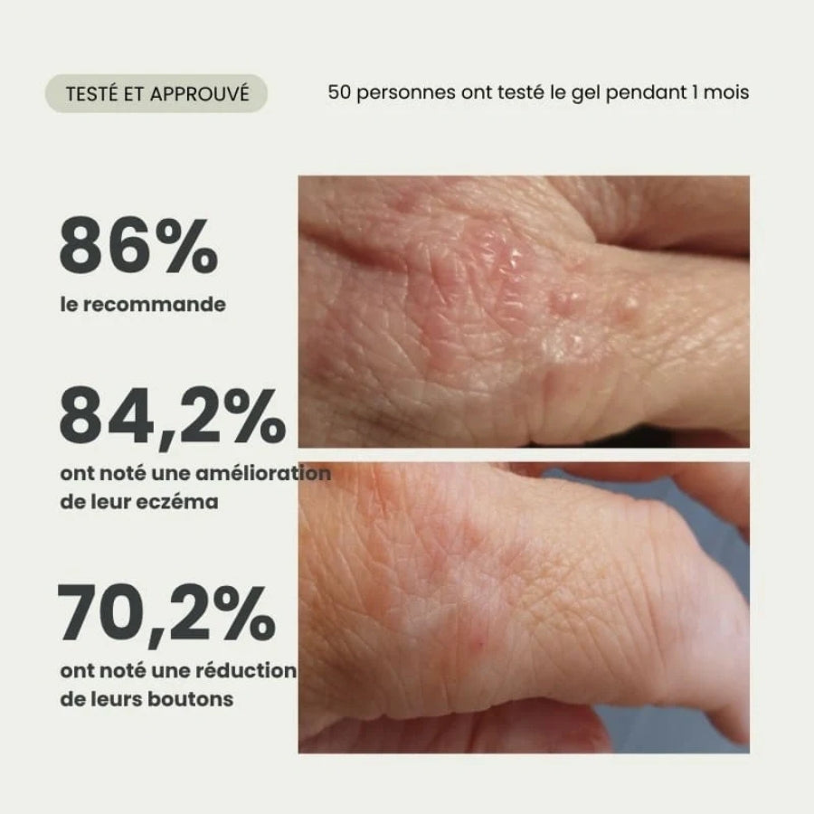 Résultats visibles suite à l'application du gel propolis purifiant bio apaisant et équilibrant à l'aloé vera natif de la marque Naturaloé