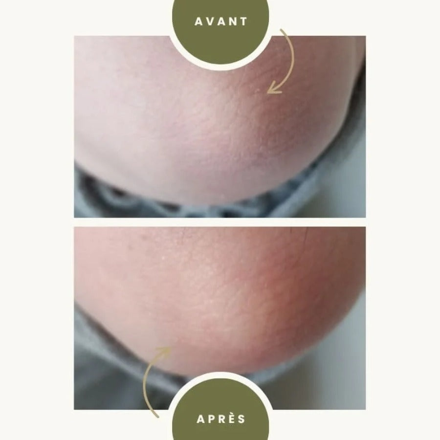 Avant/après utilisation du lait corporel bio pour peaux sèches et sensibles de la marque Naturaloé