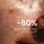 un visage avec des tâches brunes et la mention -60ù de tâches brunes en 6 jours
