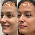 Photo avant et après application du Sérum autobronzant comme avant sur le visage
