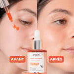 Avant - après utilisation du sérum bonne mine 10% vitamine C de 30 ml de la marque Endro