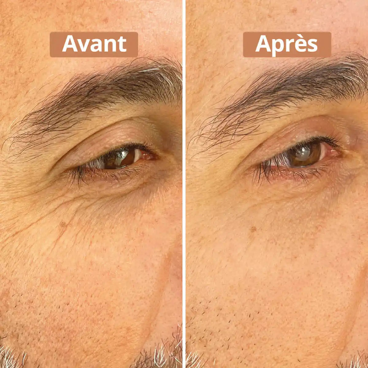 Comparaison entre avant et après application du serum contour des yeux
