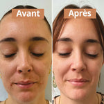Photo avant et après utilisation du sérum visage purifiant de 30 ml de la marque Comme Avant