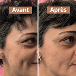 Photo avant et après utilisation du sérum visage anti-âge de 30 ml de la marque Comme Avant