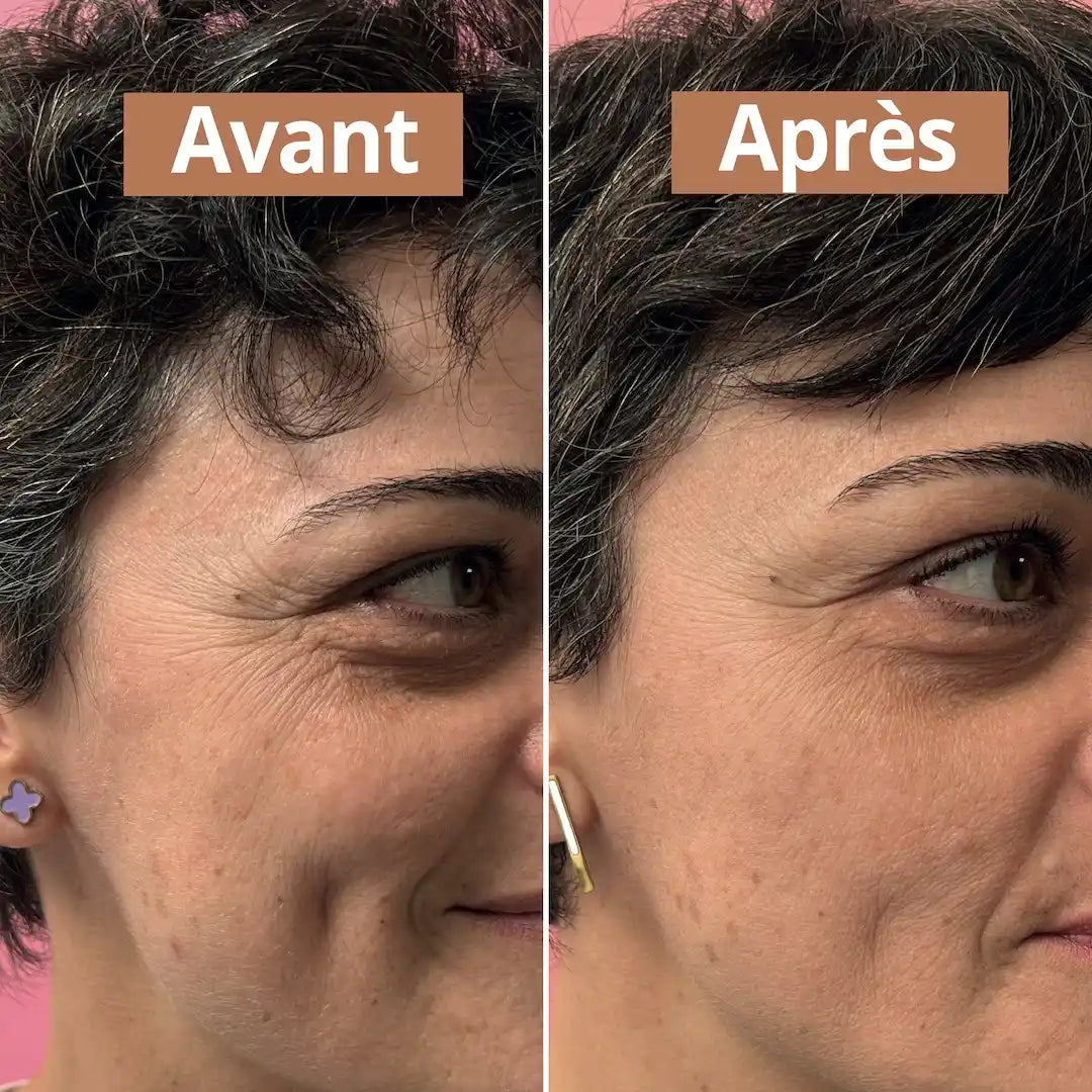 Photo avant et après utilisation du sérum visage anti-âge de 30 ml de la marque Comme Avant