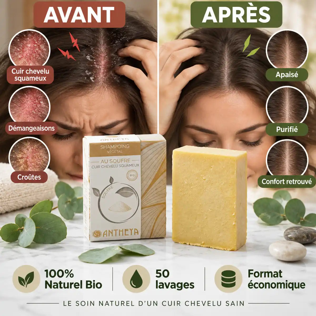 Shampoing solide Antheya au soufre : cuir chevelu squameux avant/après, 100g bio