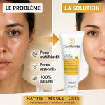 Soin matifiant miel de manuka IAA15+ avant après peau brillante pores resserrés